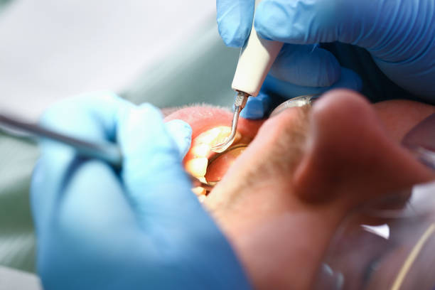 Best Root Canal Emergency Dentist  in Greensboro, NC